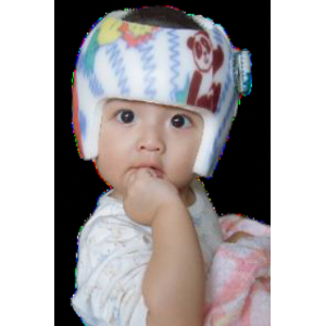 baby-cranial-helmet-01